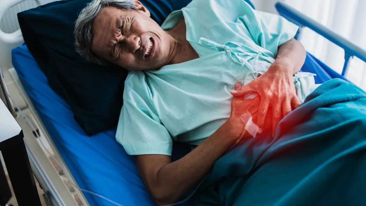 Colon cancer