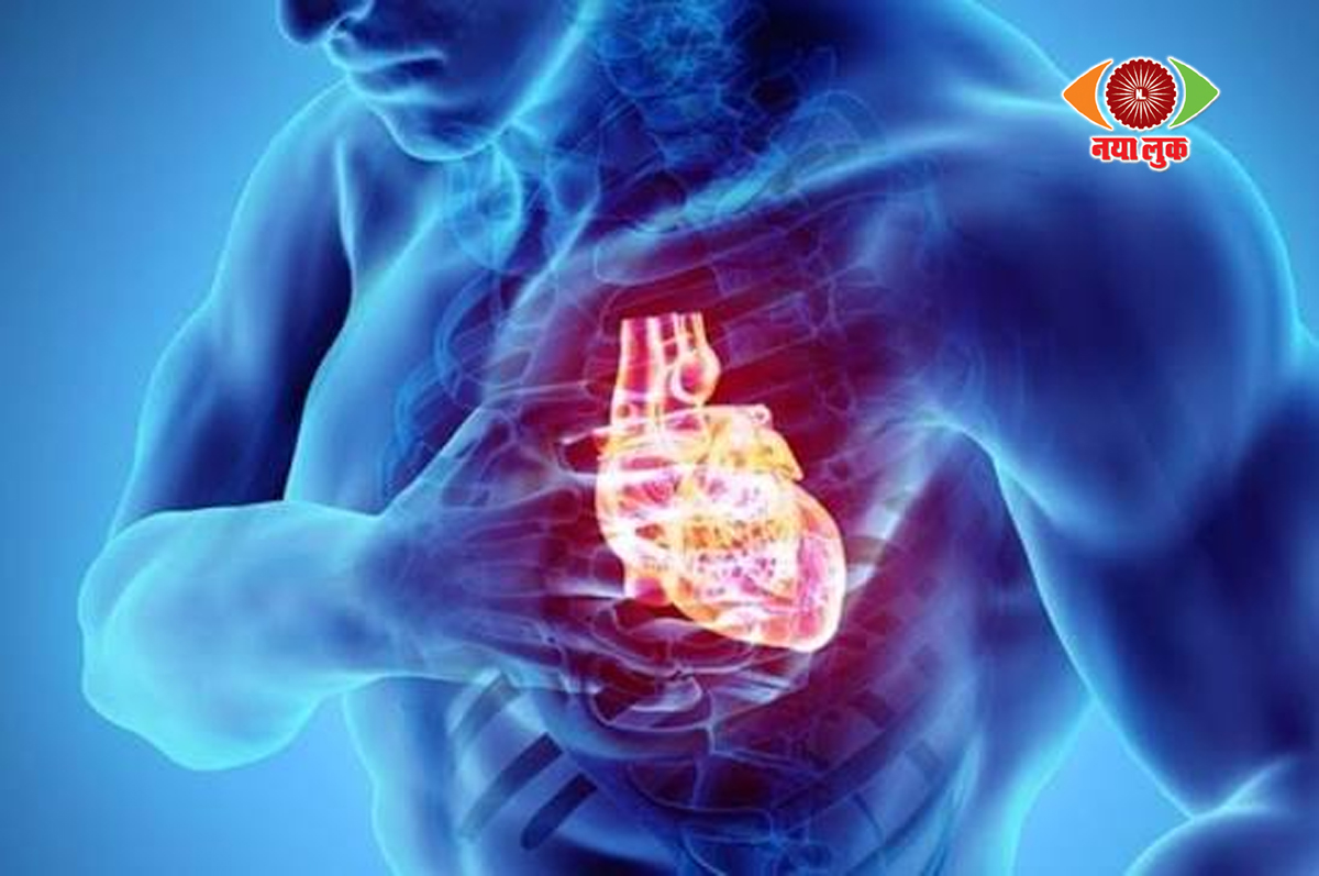 Cardiac arrest