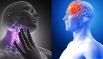 Head and Neck Cancer