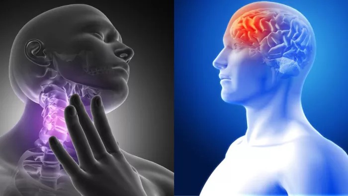 Head and Neck Cancer