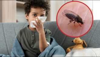 Sandfly infection