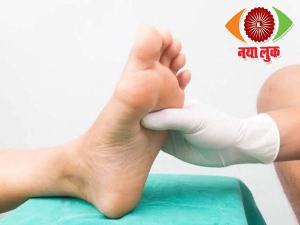 Diabetic foot