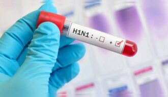 swine flu