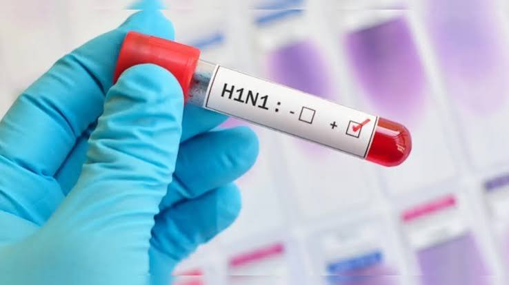 swine flu